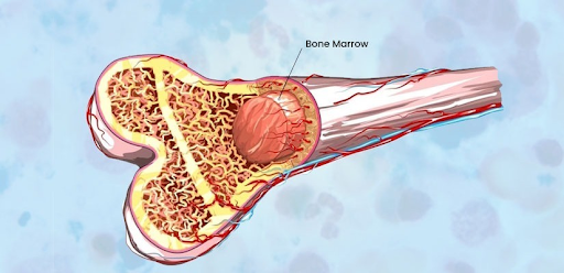 What Is Bone Marrow Transplant?